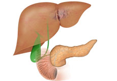 Hepatobiliary Disease